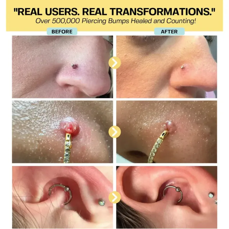 Keloid Repair Duo